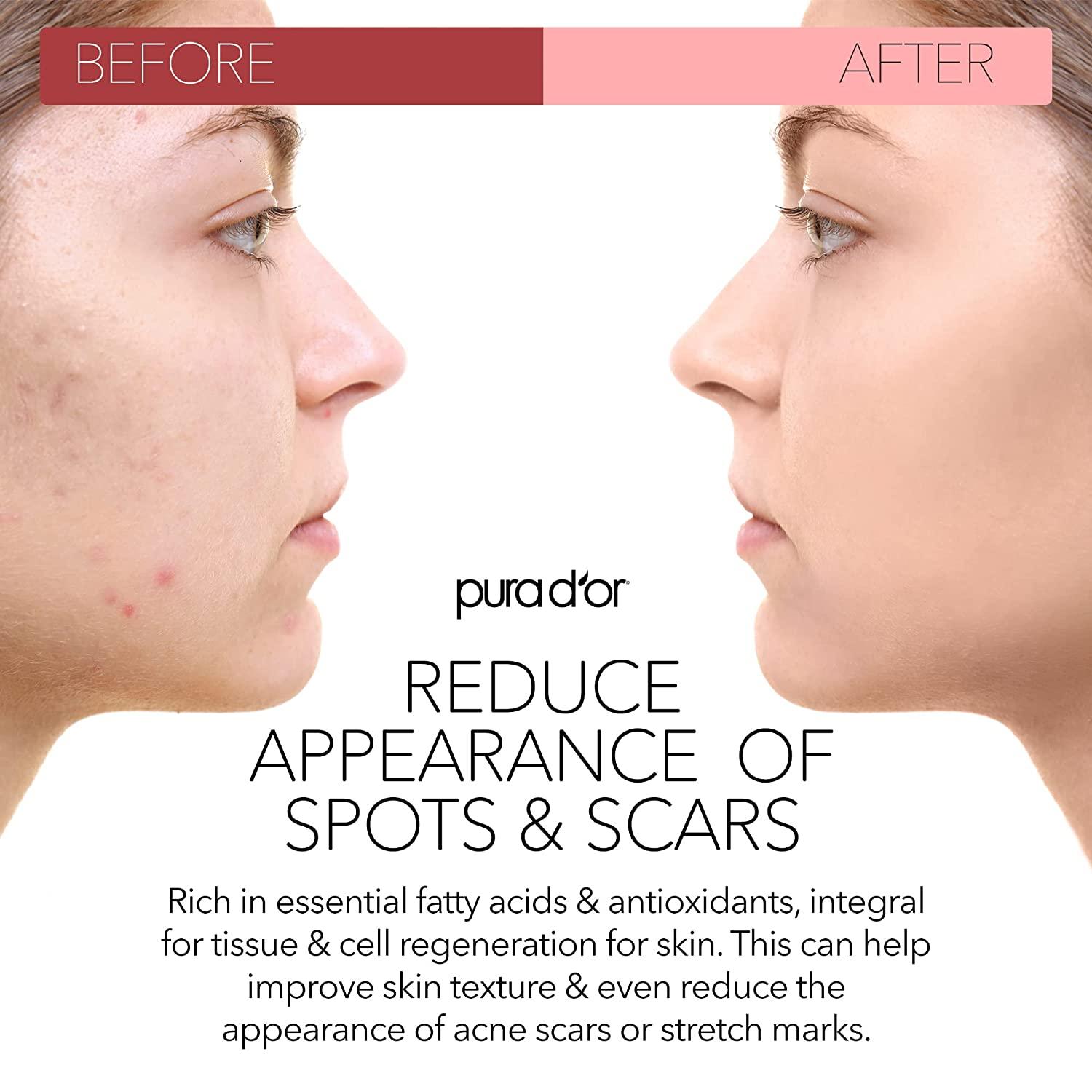 beauty product