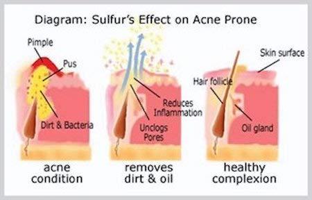 beauty product